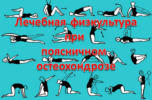 лечебная физкультура при остеохондрозе