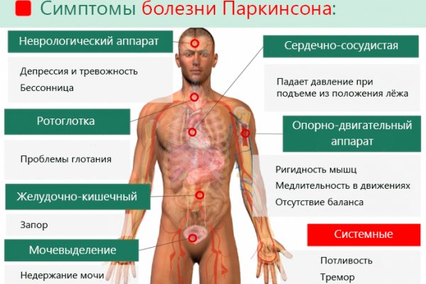 симптомы заболевания паркинсона